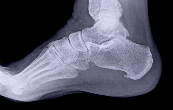 Family Footcare Provides Digital X-Rays